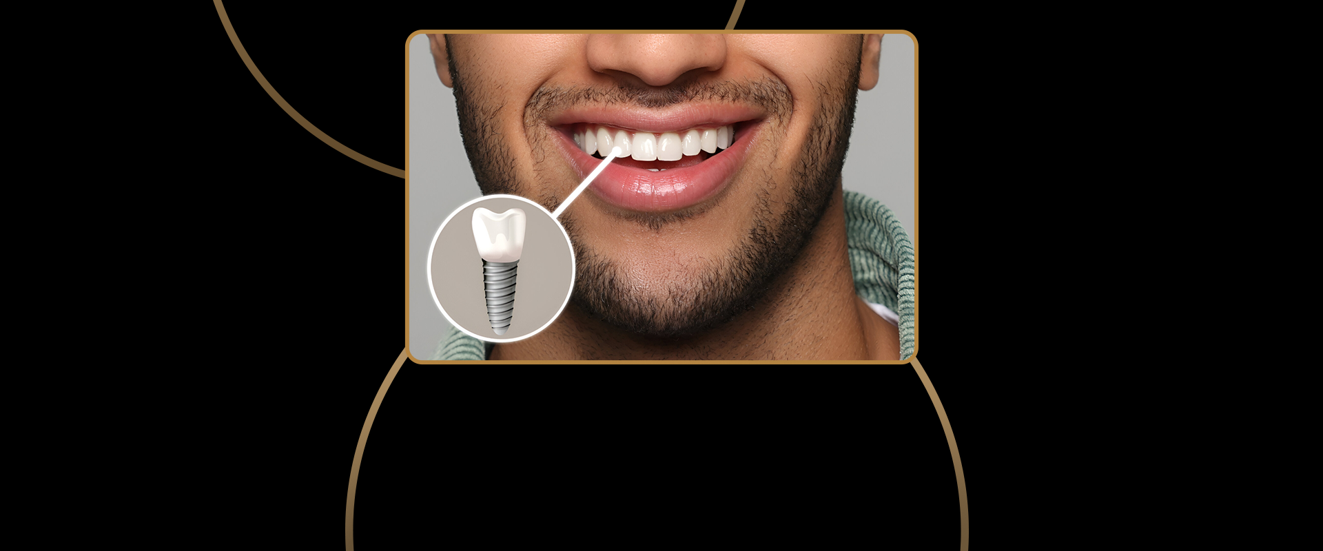 Dental Implant Aftercare